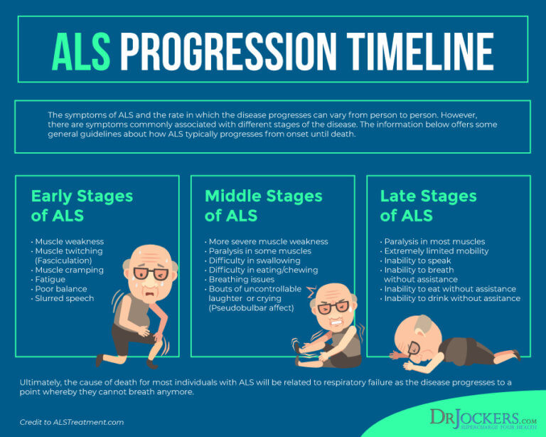 ALS: Symptoms, Causes, and Natural Support Strategies - DrJockers.com