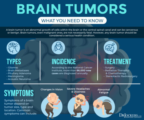 Brain Cancer: Natural Strategies to Help the Fight - DrJockers.com