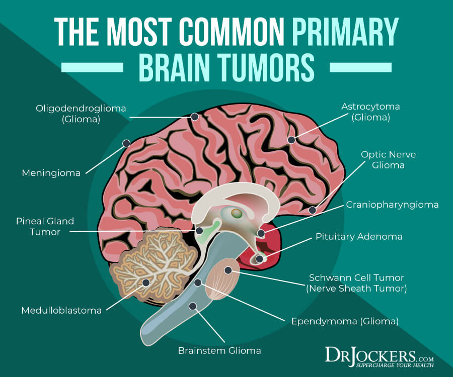 brain cancer treatment