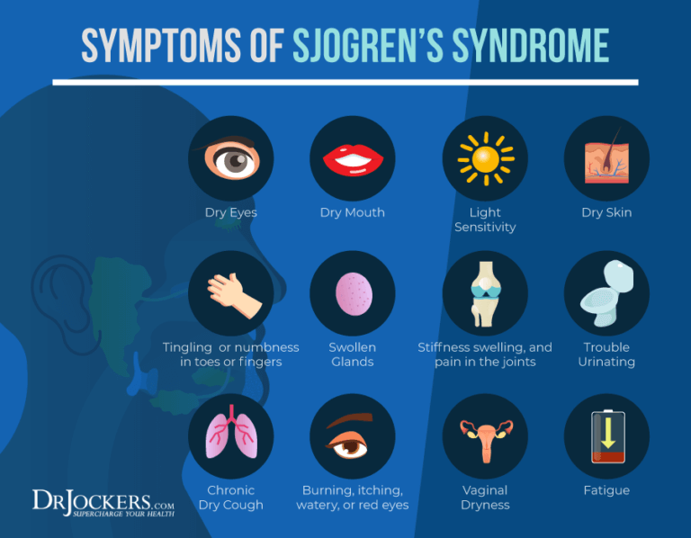 Sjogren s Syndrome Symptoms Causes And Support Strategies sjogren-s-syndrome-symptoms-causes-and-support-strategies