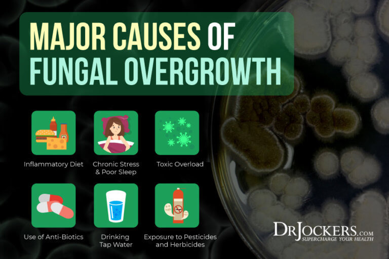 fungal-overgrowth-causes-symptoms-solutions