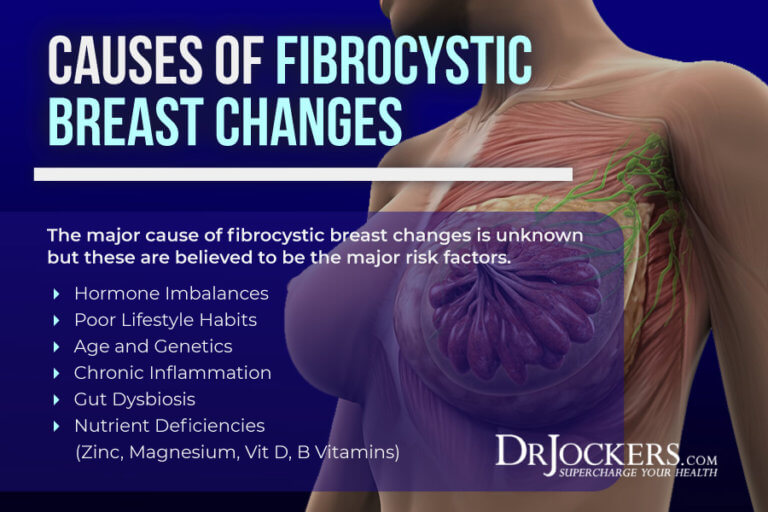 Fibrocystic Breast Changes Causes, Symptoms & Strategies