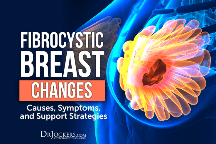 merk manuals fibrocystic breast changes