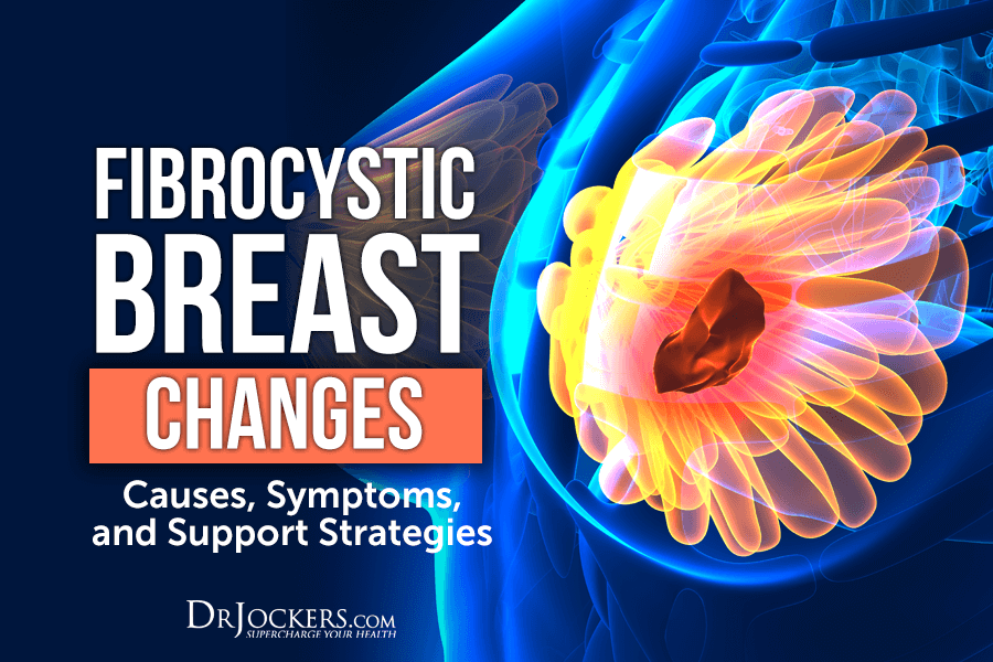 Fibrocystic Breast, Fibrocystic Breast Changes: Causes, Symptoms, and Support Strategies