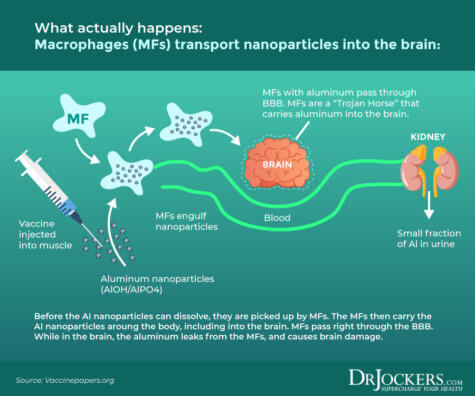 Leaky Brain Syndrome: Symptoms, Causes and Natural Solutions