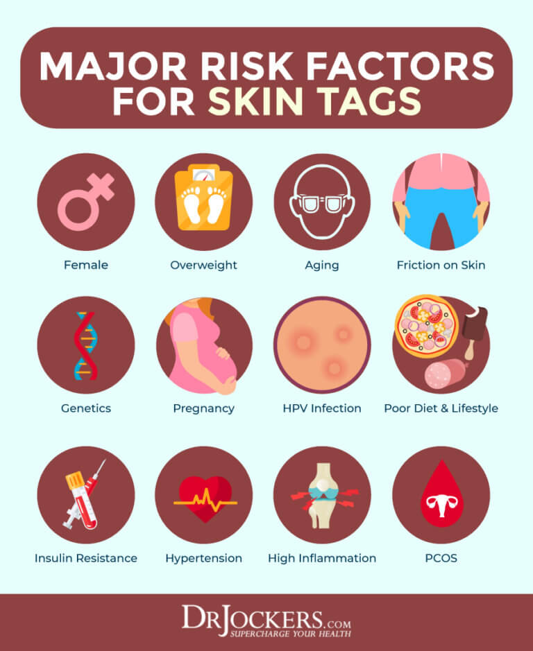 Skin Tags Major Causes And Natural Support Strategies DrJockers