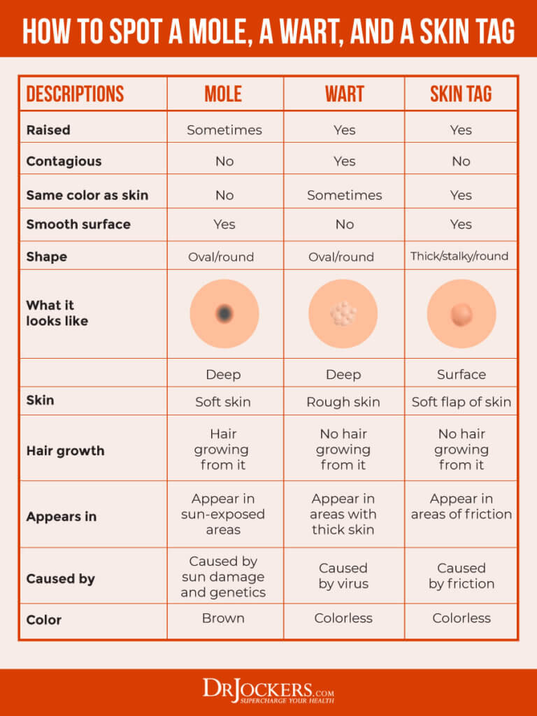 skin-tags-major-causes-and-natural-support-strategies-drjockers