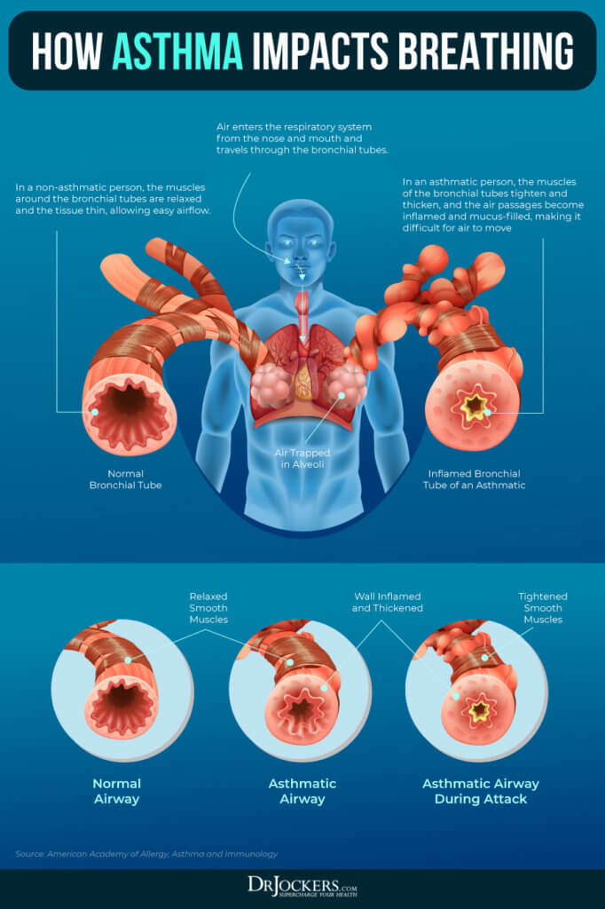 Lung Health: Risk Factors, Foods & Health Strategies