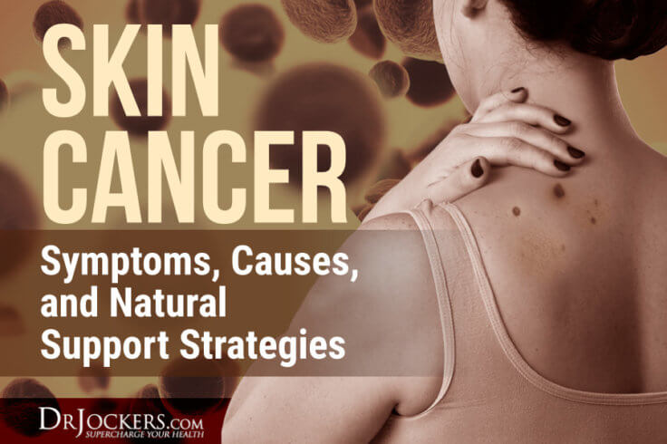 Skin Cancer Symptoms Causes And Natural Support Strategies Images