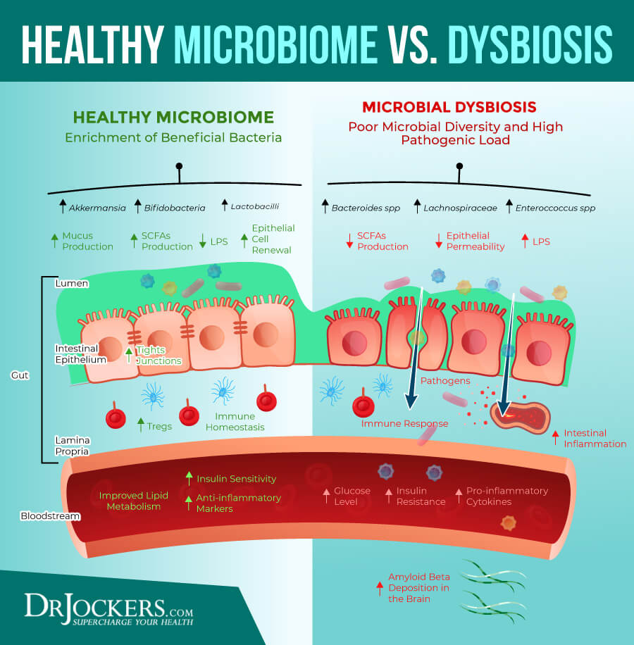 Dysbiosis, Dysbiosis: What is It and How to Heal Your Microbiome 