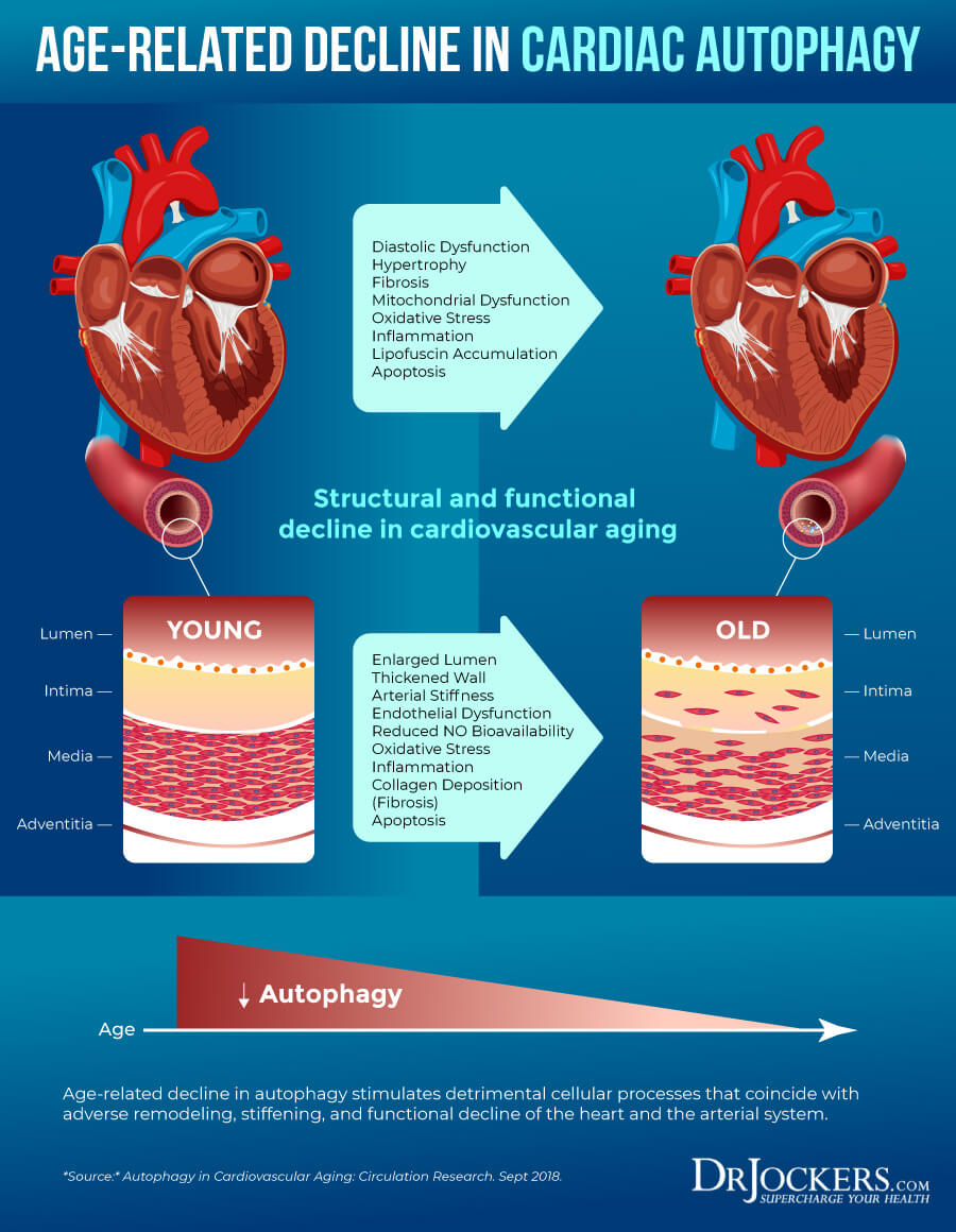 cardiac autophagy, Cardiac Autophagy: Healing Damaged Heart Cells