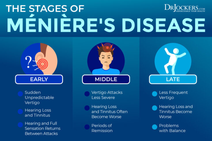 Ménières Disease Causes Symptoms And Support Strategies 7939