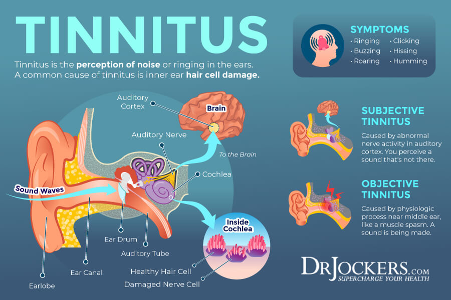 Tinnitus, Tinnitus: Symptoms, Causes and Natural Support Strategies