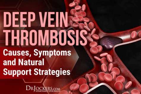 Deep Vein Thrombosis: Causes, Symptoms and Support Strategies