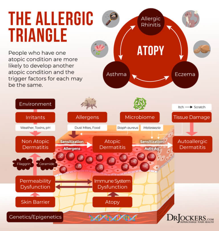 Eczema: Symptoms, Causes & Support Strategies - DrJockers.com