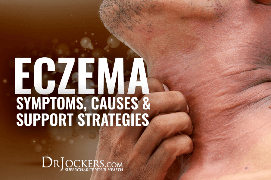 eczema, Eczema: Symptoms, Causes &#038; Support Strategies