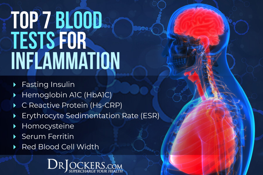 Inflammaging, Inflammaging: The Role of Inflammation in the Acceleration of Aging