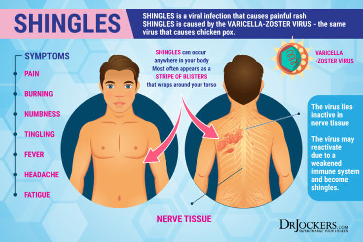 Shingles: Symptoms, Risk Factors, and Natural Support Strategies