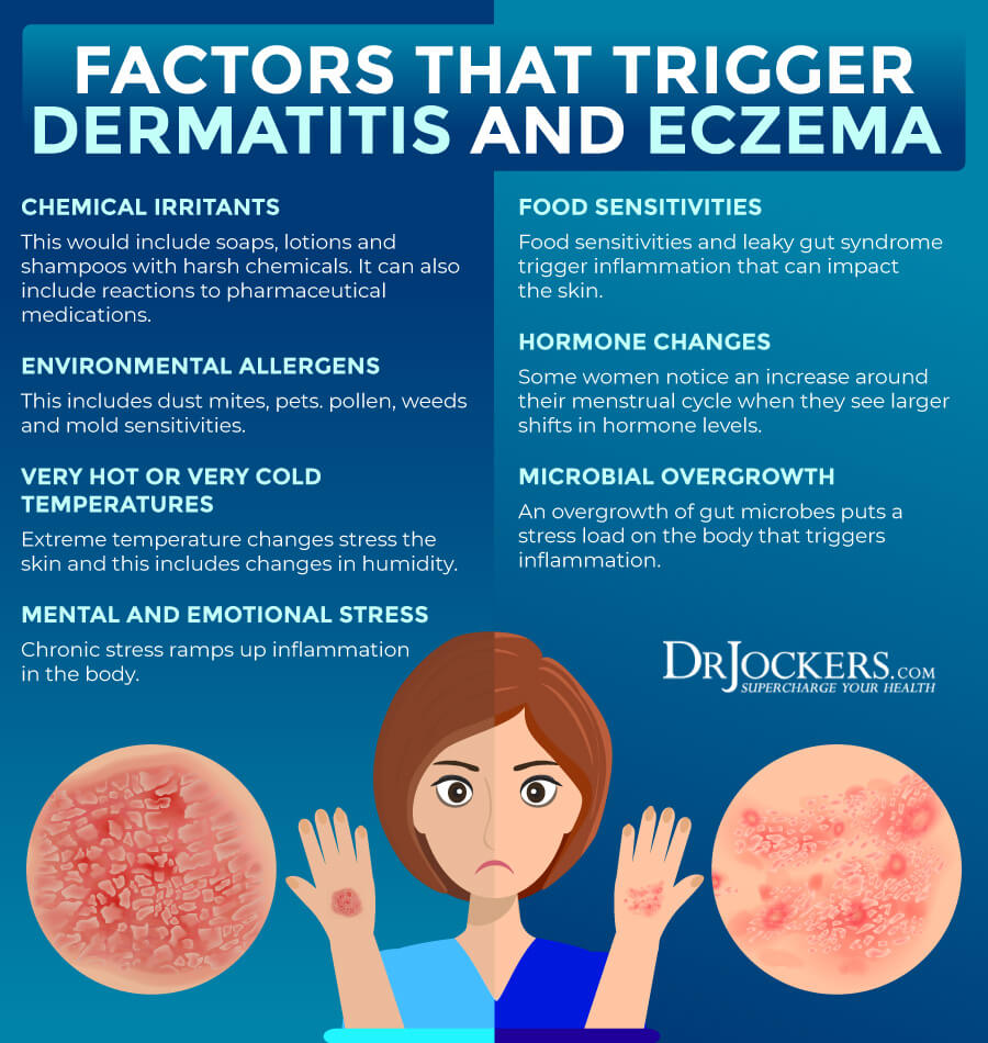 Dermatitis Causes Dermatitis Causes