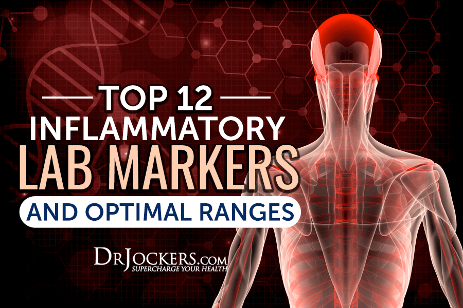inflammatory, Top 12 Inflammatory Lab Markers and Optimal Ranges