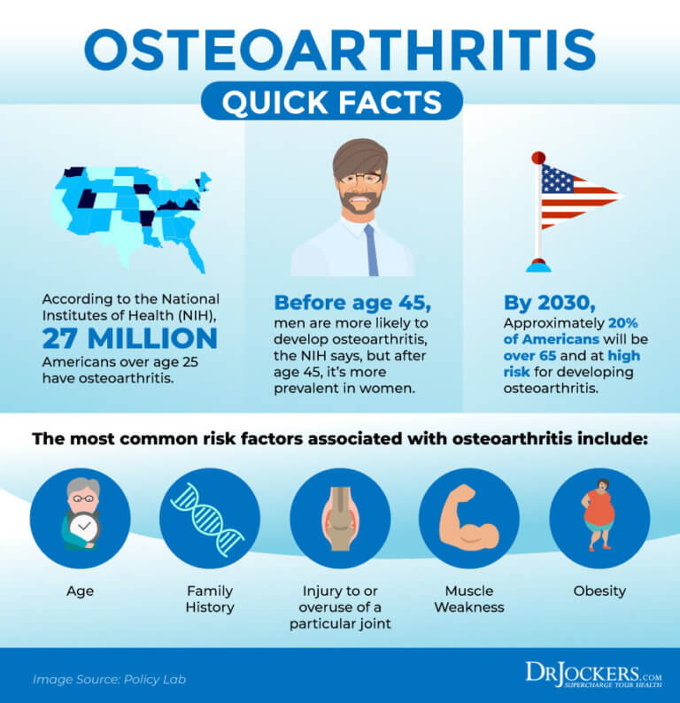 Osteoarthritis: Symptoms, Causes and Natural Support Strategies