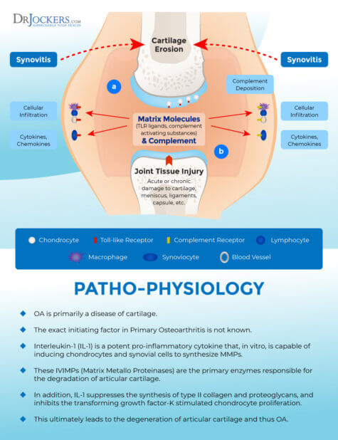 Osteoarthritis: Symptoms, Causes And Natural Support Strategies