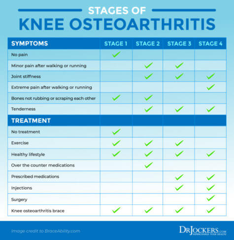 Osteoarthritis: Symptoms, Causes and Natural Support Strategies