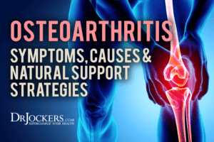 Osteoarthritis: Symptoms, Causes and Natural Support Strategies