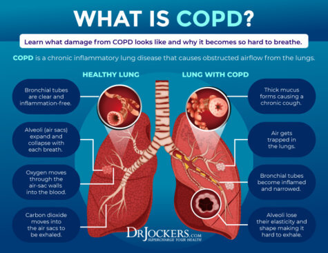 COPD: Symptoms, Causes, and Support Strategies - DrJockers.com