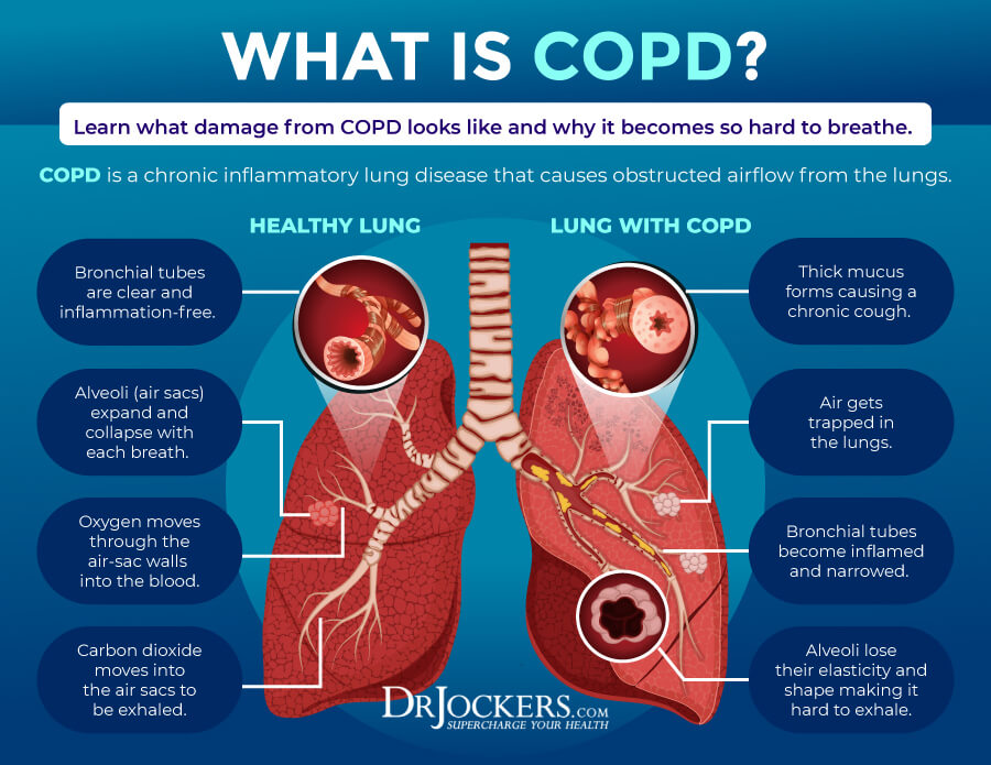 COPD, COPD: Symptoms, Causes, and Support Strategies