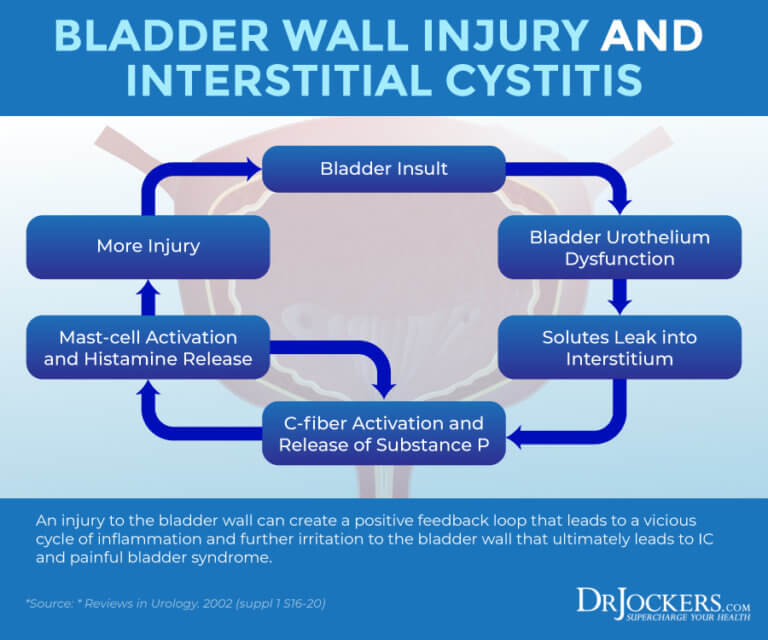 Interstitial Cystitis Symptoms Causes And Support Strategies