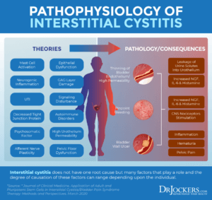 Interstitial Cystitis: Symptoms, Causes And Support Strategies