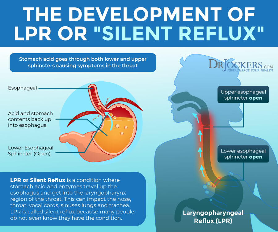 silent reflux, Silent Reflux: Symptoms, Causes, and Support Strategies