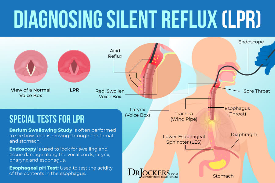 silent reflux