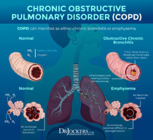 COPD: Symptoms, Causes, and Support Strategies - DrJockers.com