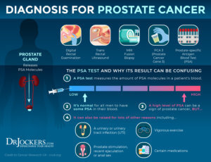 Prostate Cancer: Symptoms, Causes and Support Strategies