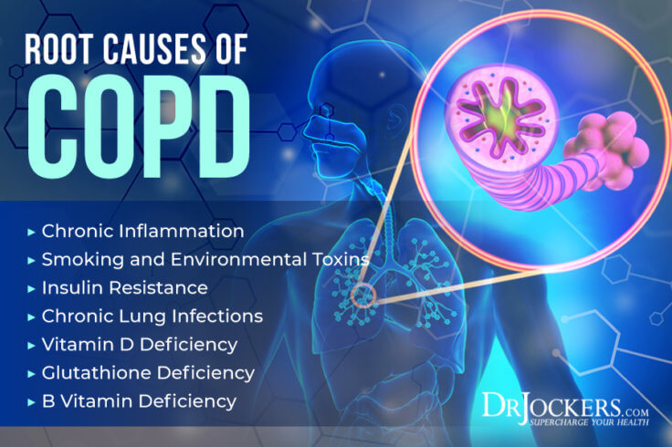 COPD: Symptoms, Causes, and Support Strategies - DrJockers.com