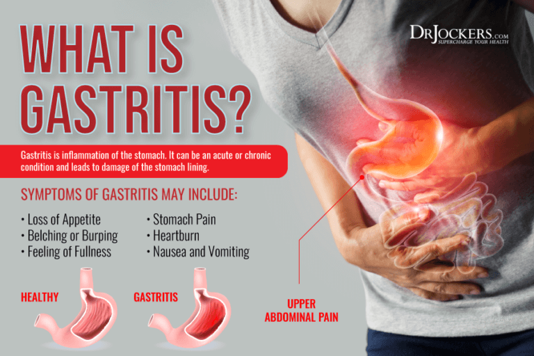 gastritis-symptoms-causes-and-support-strategies-drjockers