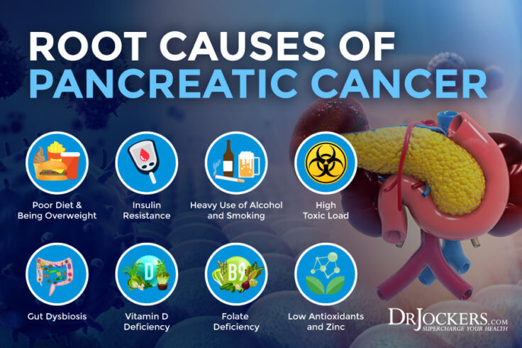 Pancreatic Cancer: Symptoms, Causes And Support Strategies