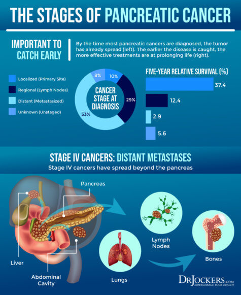 Pancreatic Cancer Symptoms Causes And Support Strategies