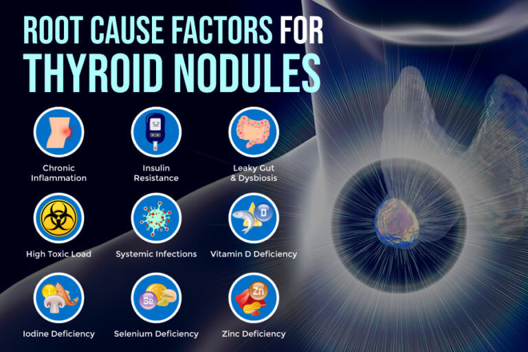 Thyroid Nodules: Symptoms, Causes, And Support Strategies