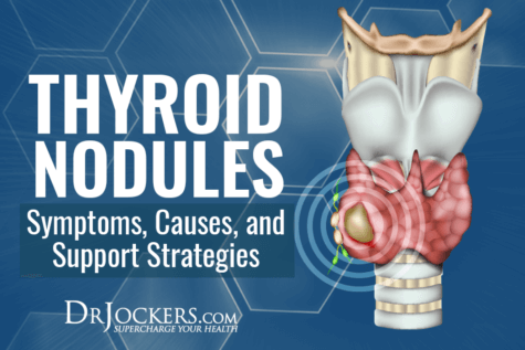 Thyroid Nodules: Symptoms, Causes, and Support Strategies