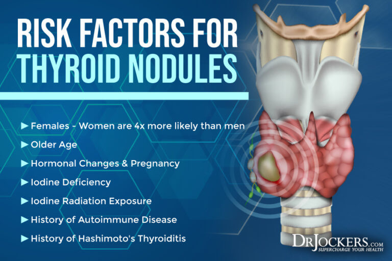 Thyroid Nodules Symptoms Causes And Support Strategies