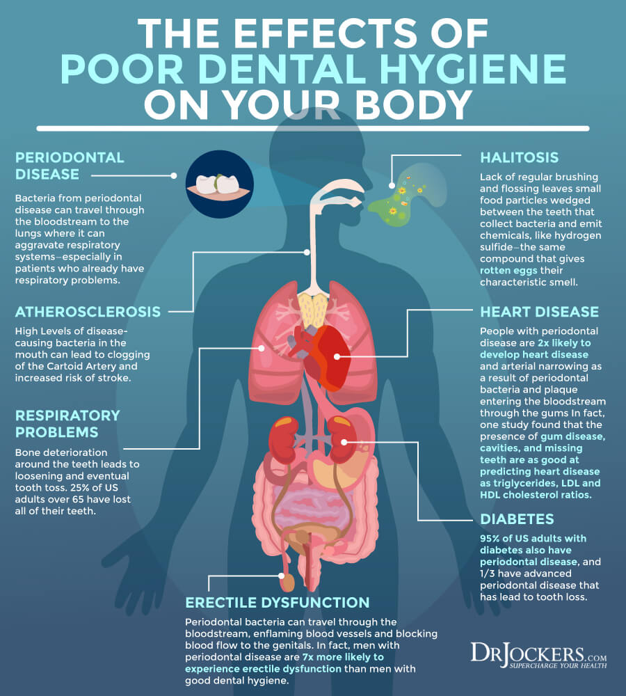 dental, Holistic Dental Care and the Oral Microbiome