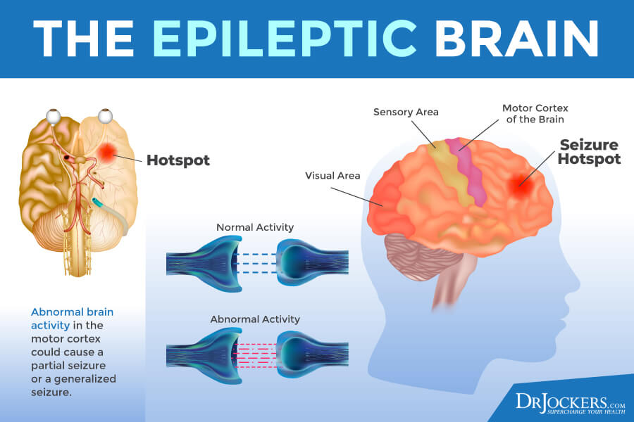Epilepsy, Epilepsy: Risk Factors and Natural Support Strategies