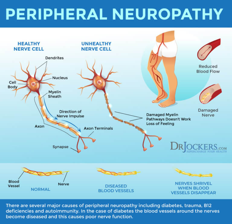 new research on neuropathy