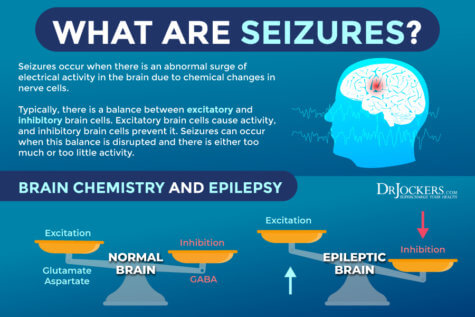 Epilepsy: Risk Factors and Natural Support Strategies - DrJockers.com