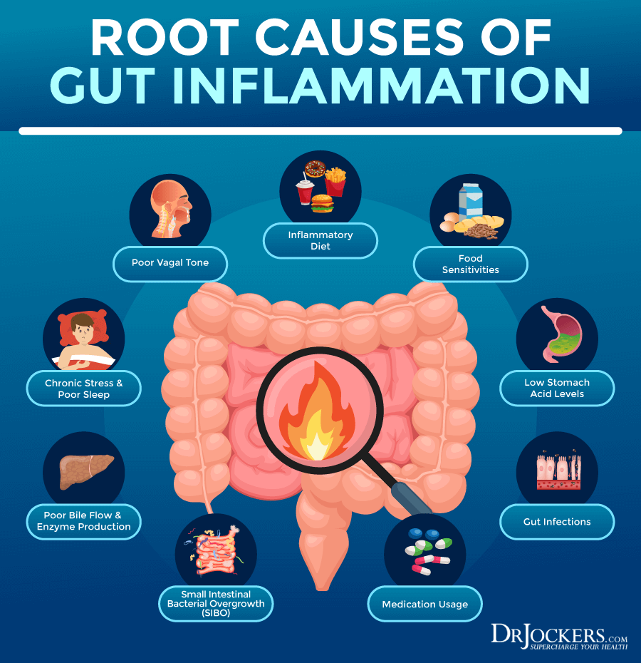gut inflammation, Gut Inflammation: Causes, Testing &#038; Support Strategies