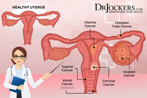 Endometrial Cancer: Symptoms, Causes, and Support Strategies