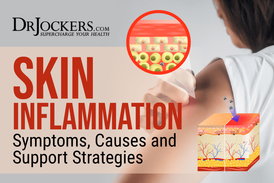 skin inflammation, Skin Inflammation: Symptoms, Causes, and Support Strategies